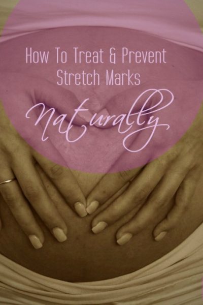 treat stretch marks