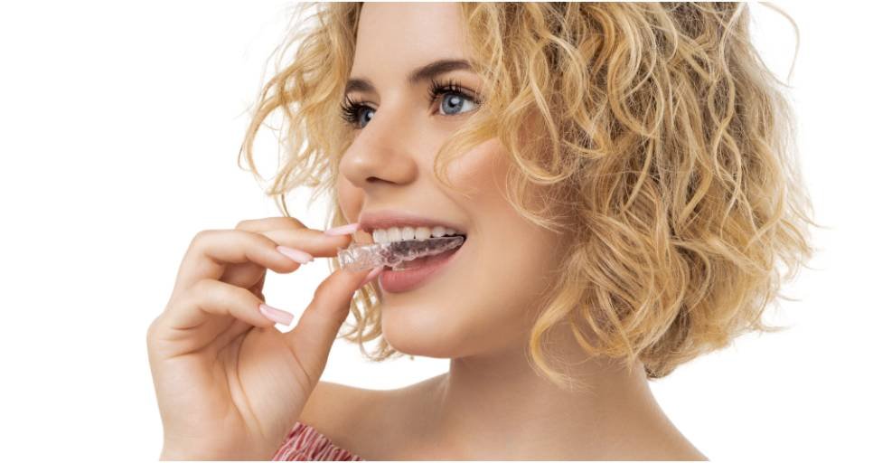 A Step-by-Step Look at Clear Aligner Treatment in Johns Creek