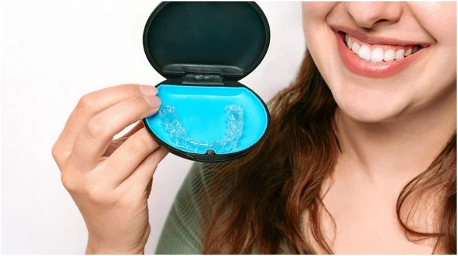 Switch Aligners And Attend Regular Check Visits