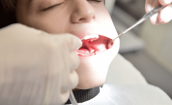 Common Causes of Bite Problems