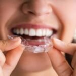 The 22-Hour Habit - Why Clear Aligners Expose Your Willpower