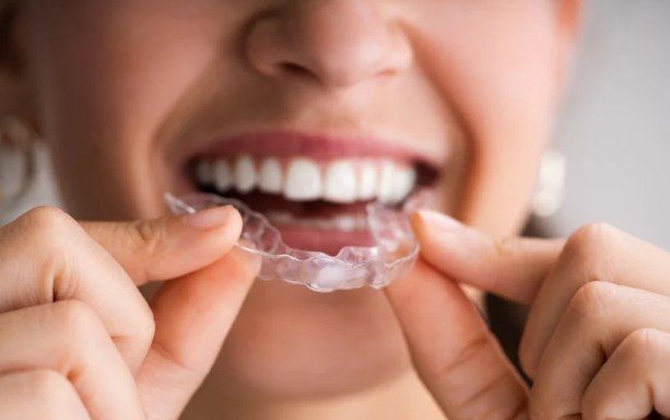 The 22-Hour Habit - Why Clear Aligners Expose Your Willpower